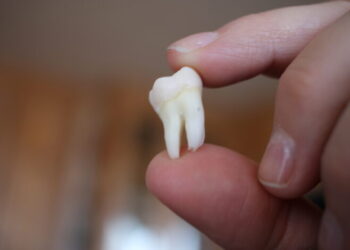 C’est quoi une dent de sagesse