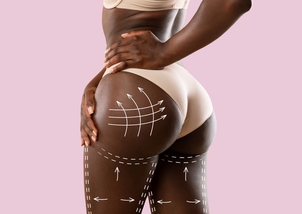 CHIRURGIE ESTHETIQUE : Ces conditions inhérentes qui sont régies par la profession